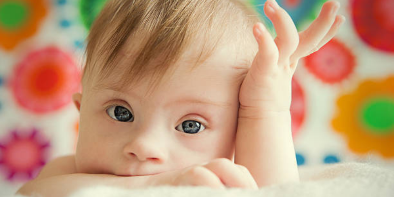 Kenapa Bisa Terjadi Down Syndrome?
